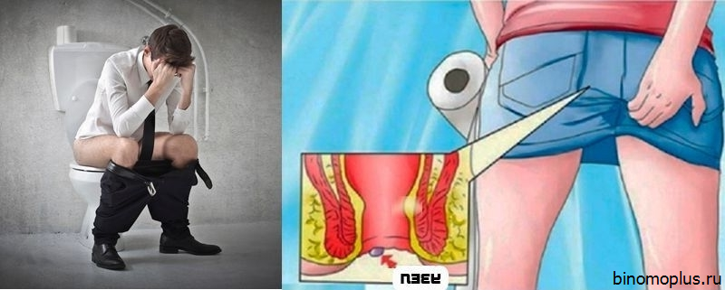 Запор После Секса