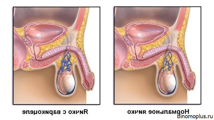 После Секса Болят Яички