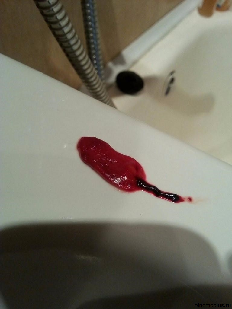 Кровь После Первого Секса